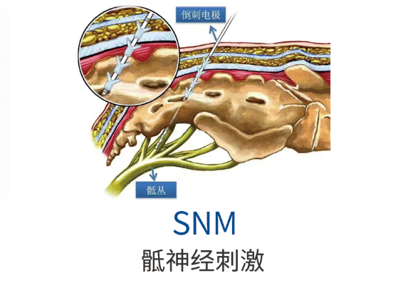 413a22a9a4cf745e46009a0bb2c42ef1.png 413a22a9a4cf745e46009a0bb2c42ef1.png